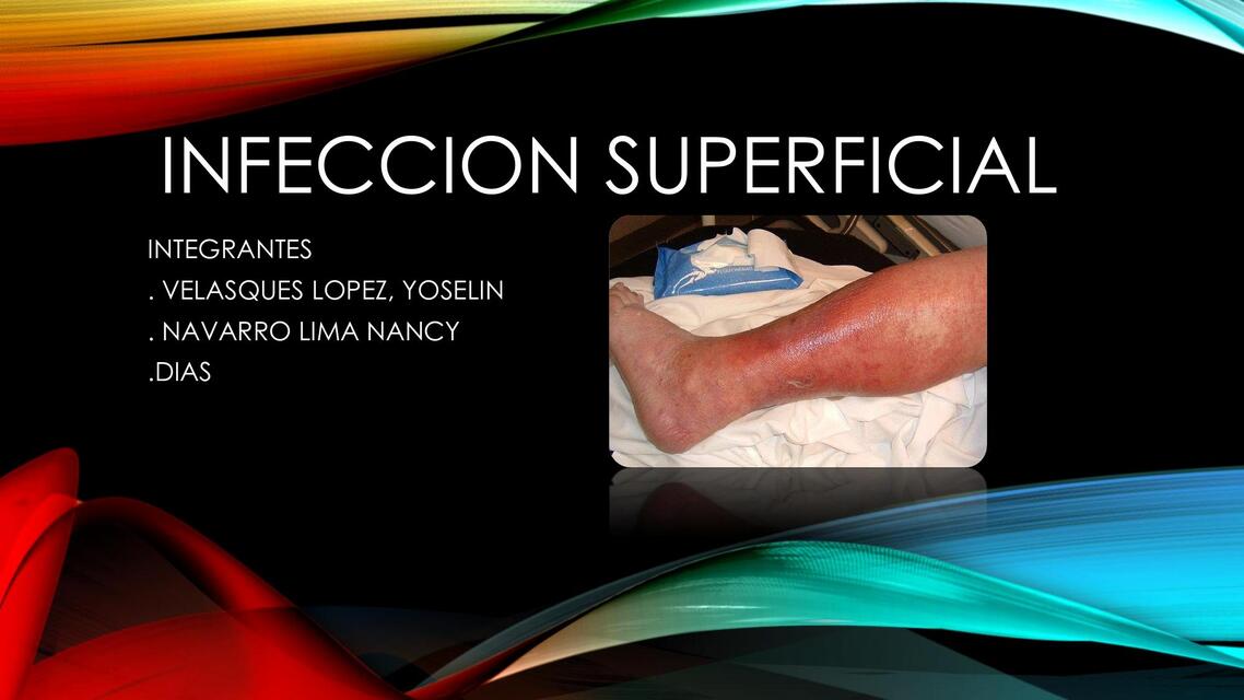 micosis superficial 1