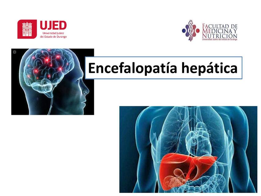 Encefalopatía hepática