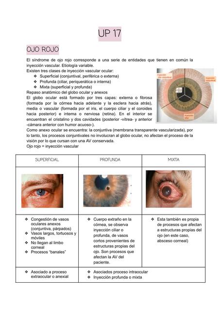 Ojo rojo y ulceras gastroduodenales