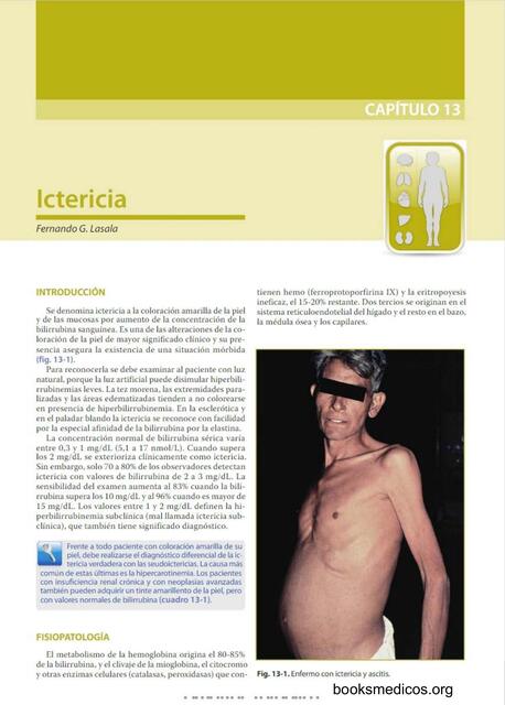 ICTERICIA ARGENTE