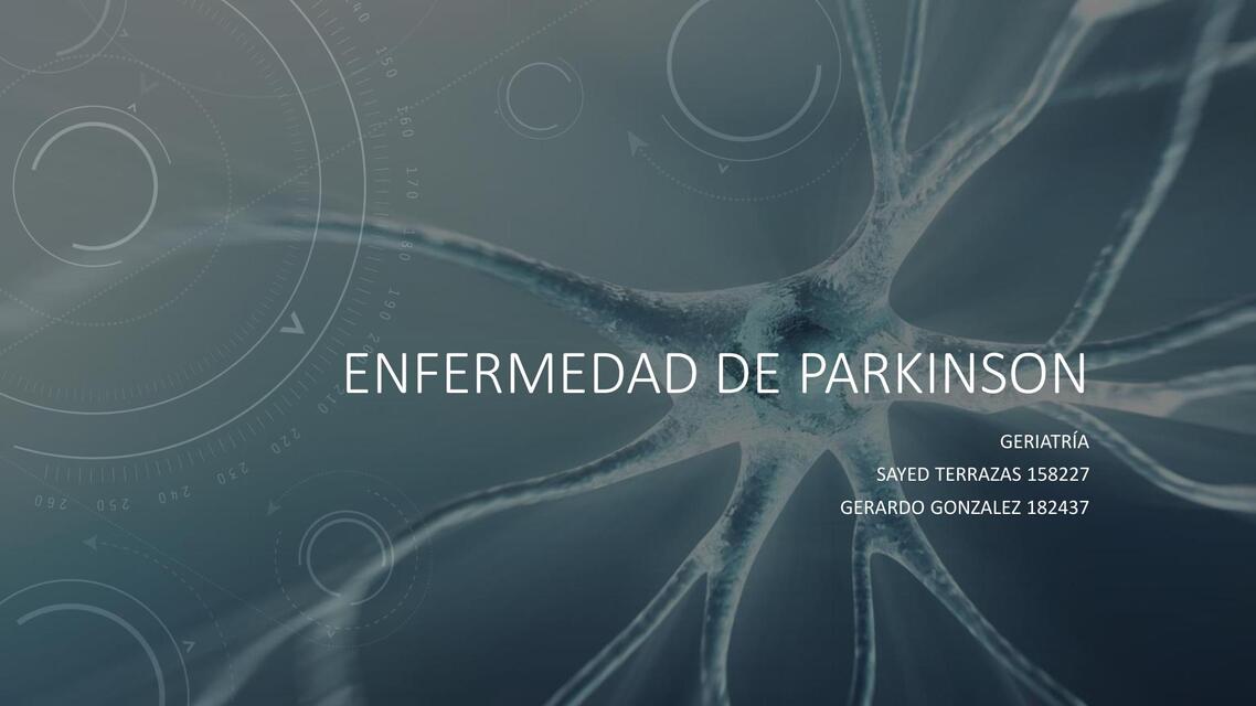 Enfermedad de Parkinson