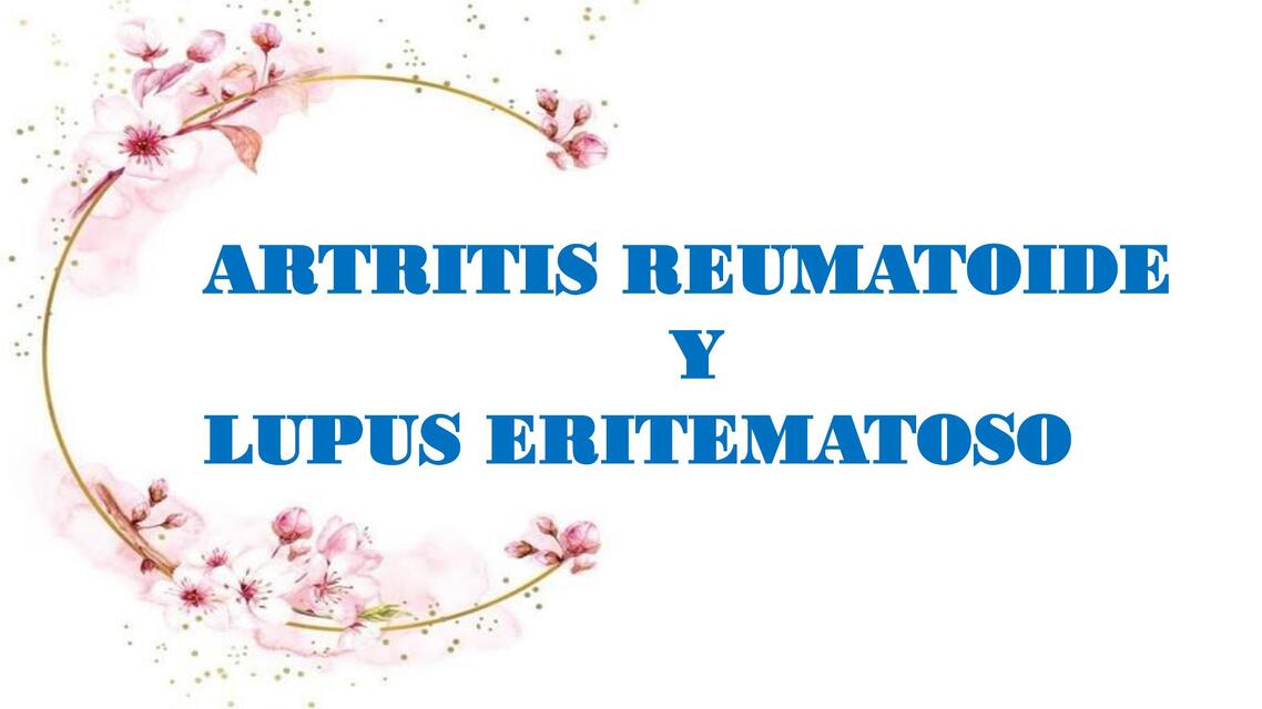 Artritis Reumatoide y Lupus Eritematoso