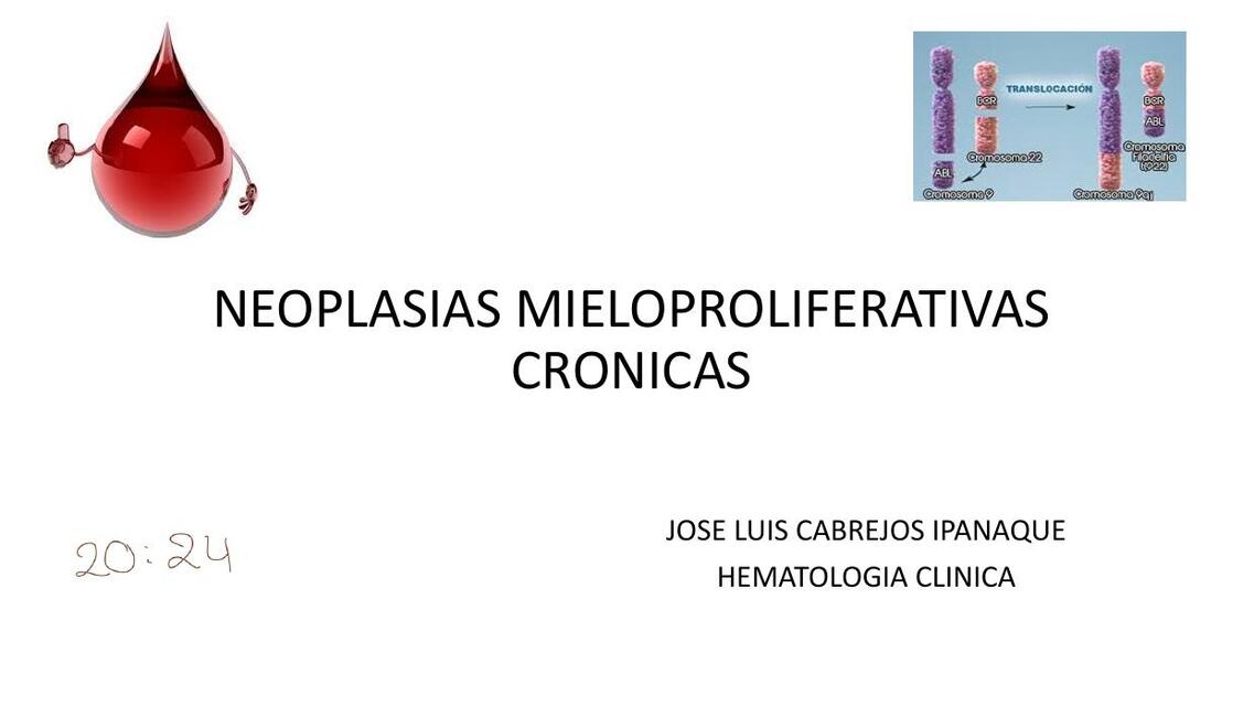 NEOPLASIS MIELOPROLIFERATIVAS pptx 1