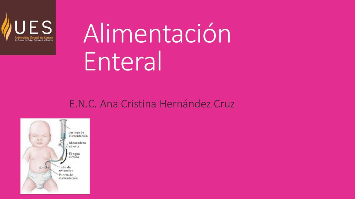 Alimentación Enteral