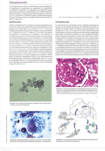 Histoplasmosis Murray