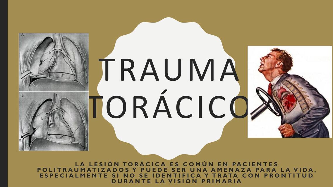 TRAUMA A