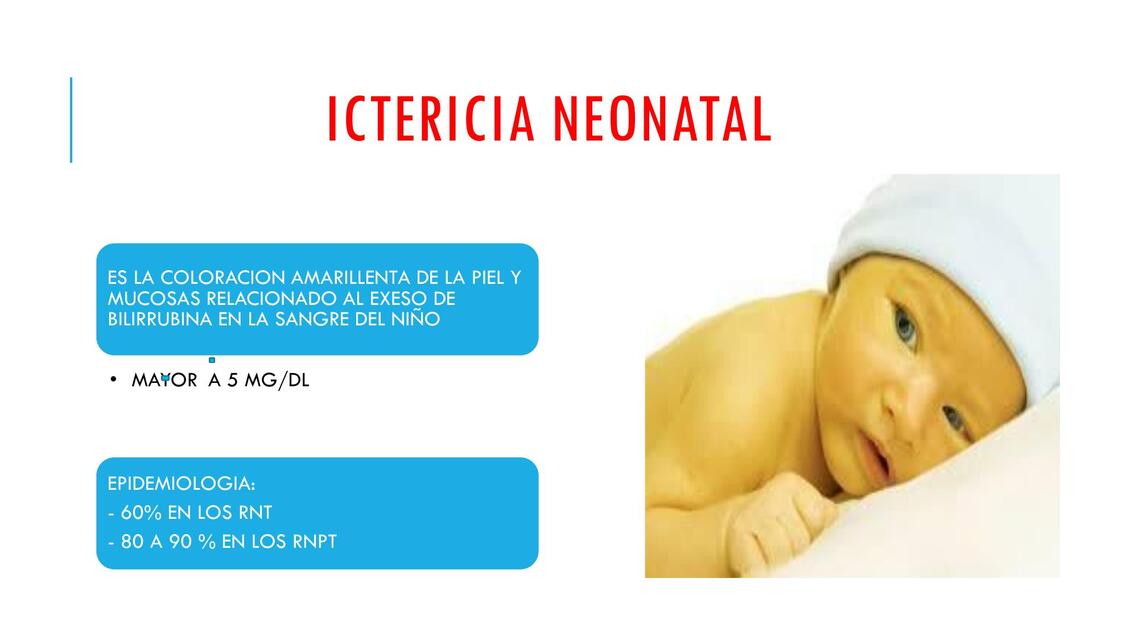 ICTERICIA NEONATAL