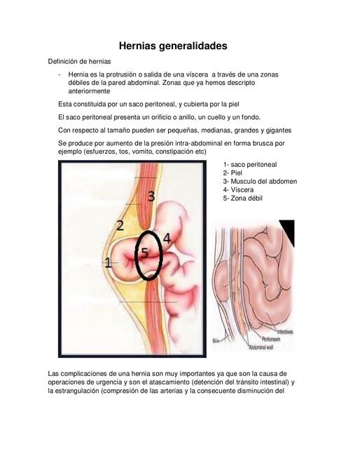 Hernias generalidades