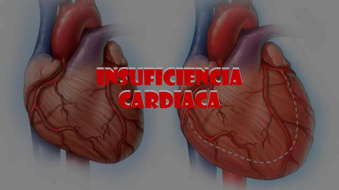 Insuficiencia cardiaca