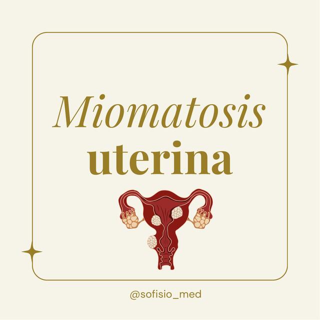 Miomatosis uterina