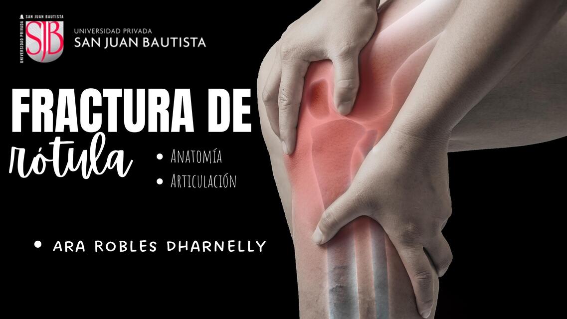 FRACTURA DE ROTULA