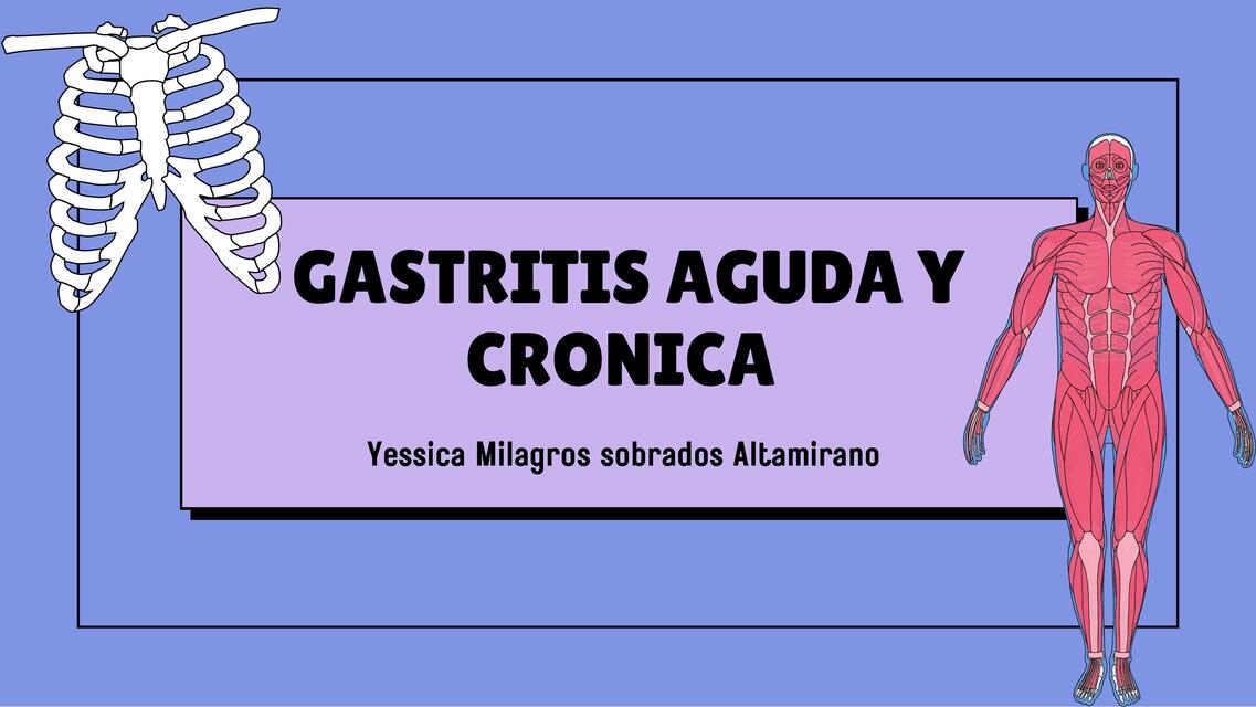 Gastritis aguda y cronica