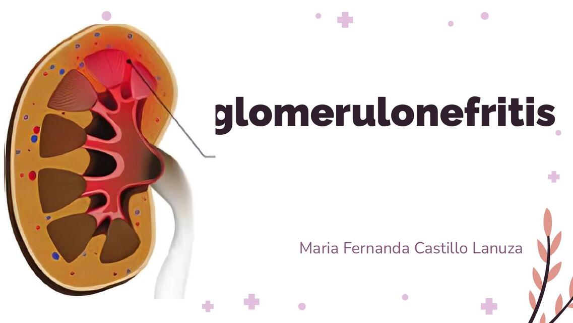 GLOMERULONEFRITIS | Jorgesantiago Mandujano | uDocz