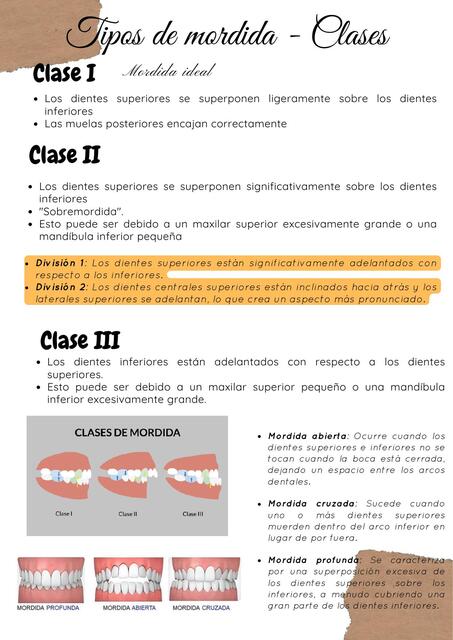 Tipos de mordida