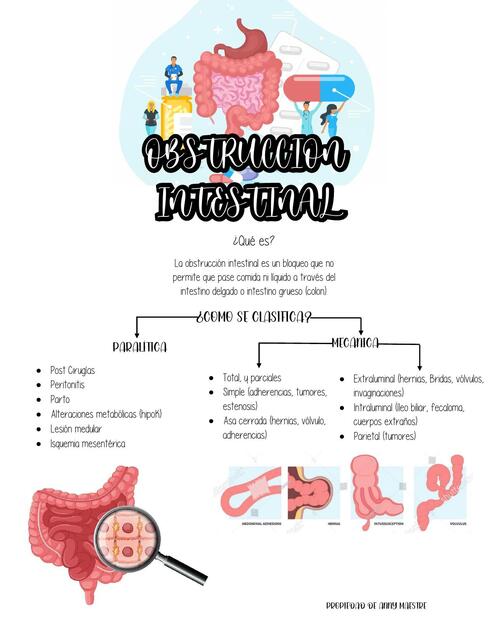 Obstrucción intestinal