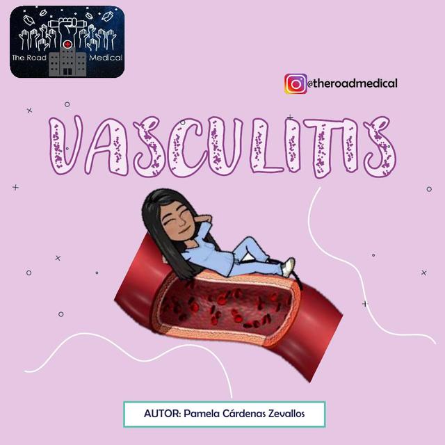 VASCULITIS THE ROAD MEDICAL uDocz