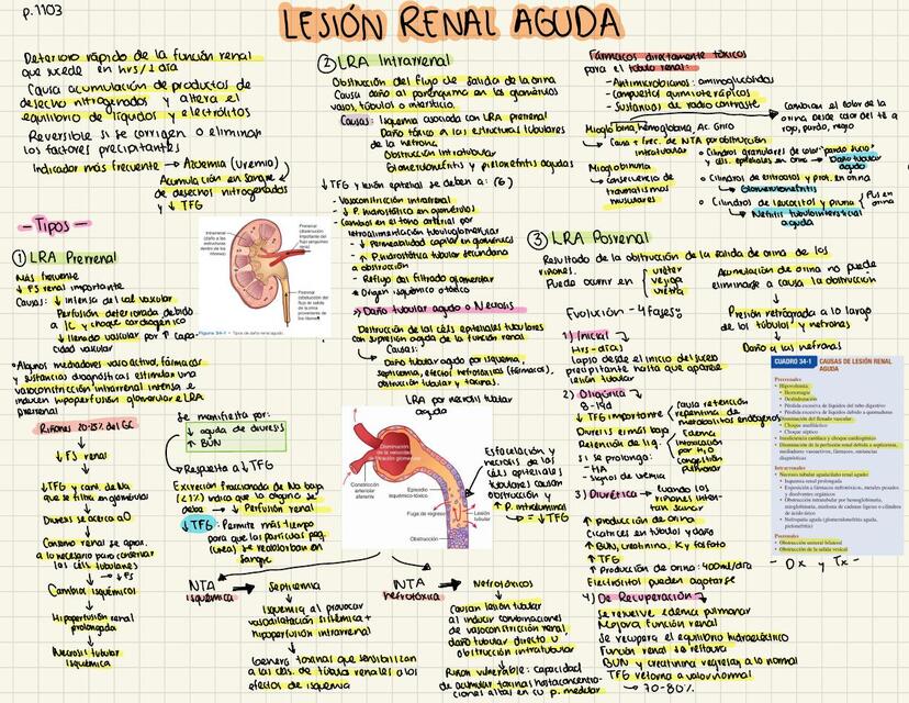 Lesión renal aguda