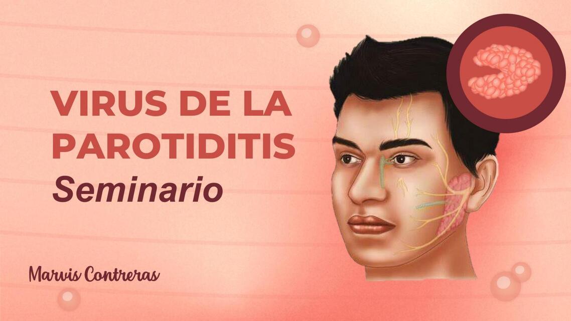 Parotiditis