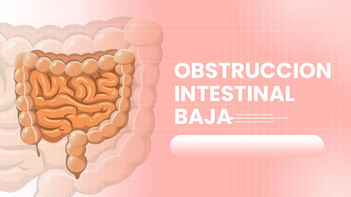 Comparto obstruccion intestinal baja contigo