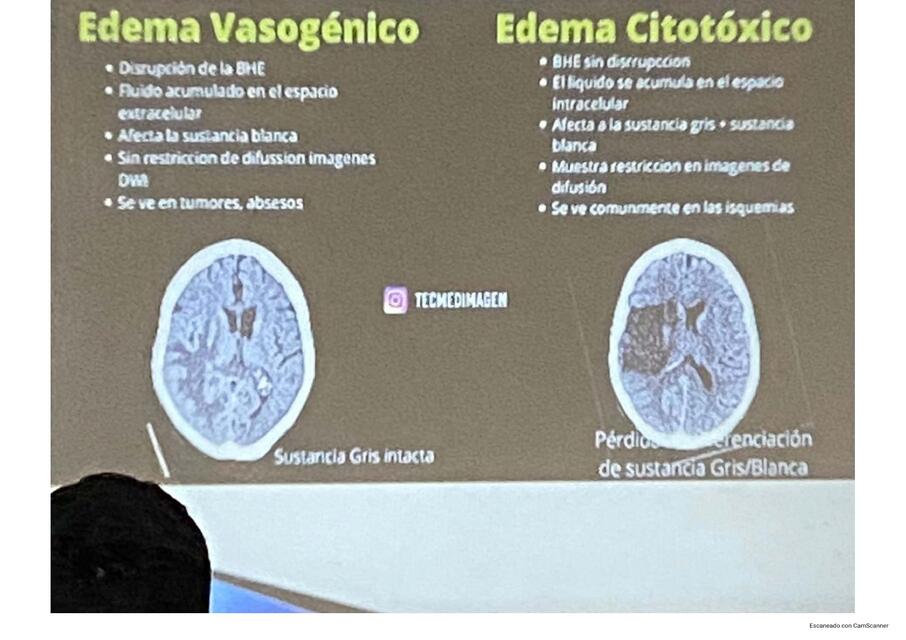 SNC diapositivas que faltan