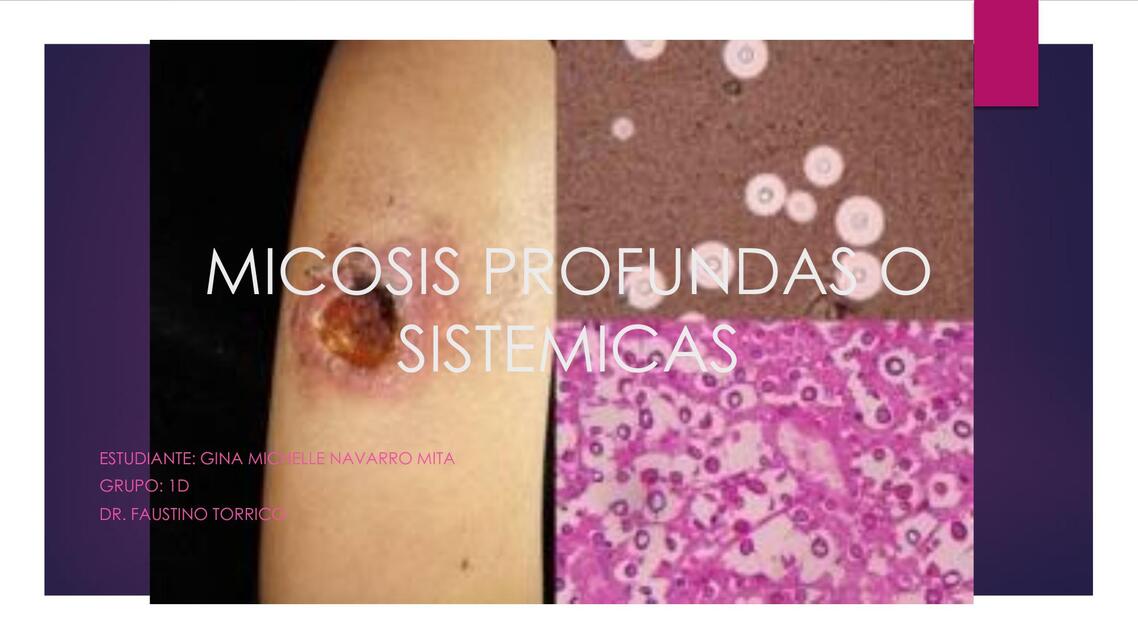 MICOSIS PROFUNDAS O SISTEMICAS