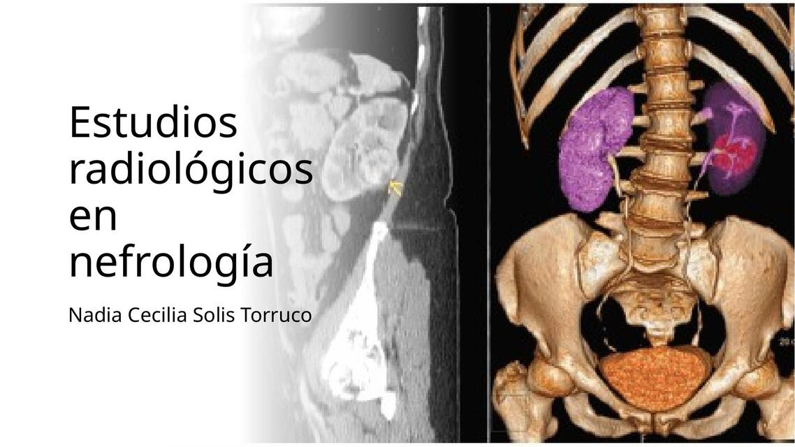 Estudios radiológicos en nefrología