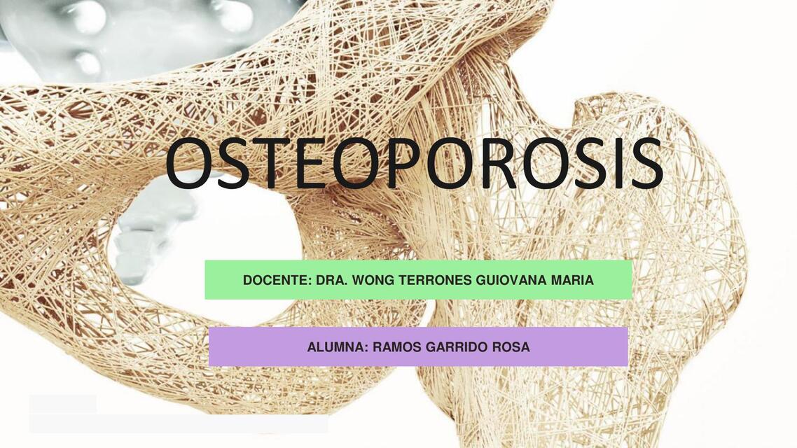 OSTEOPOROSIS