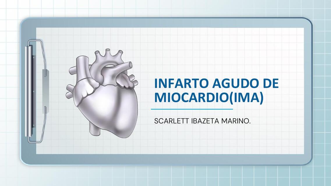 Infarto agudo de miocardio