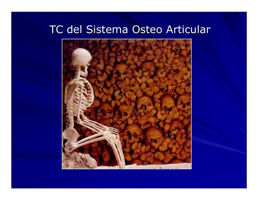 tac osteo articular