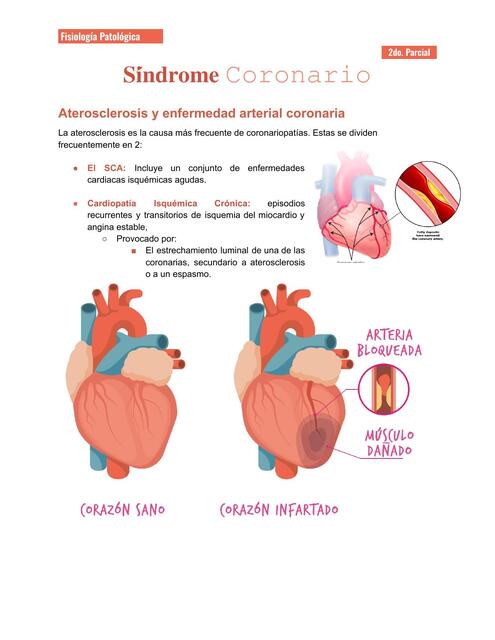 Síndrome Coronario