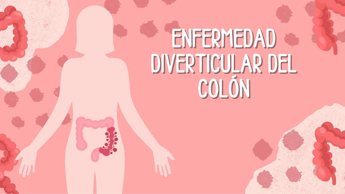 Enfermedad diverticular