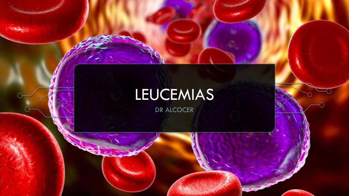 LEUCEMIAS