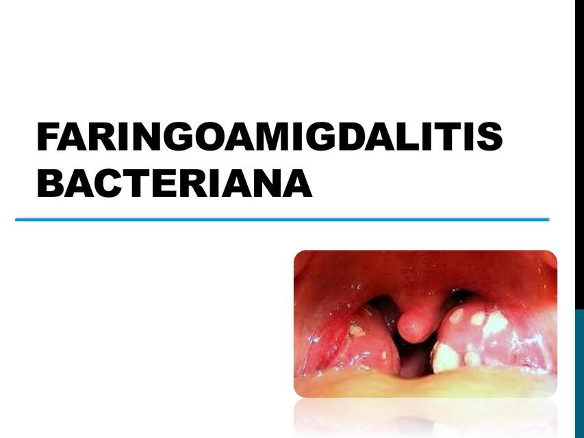 faringoamigdalitispediatria conversion gate02 1