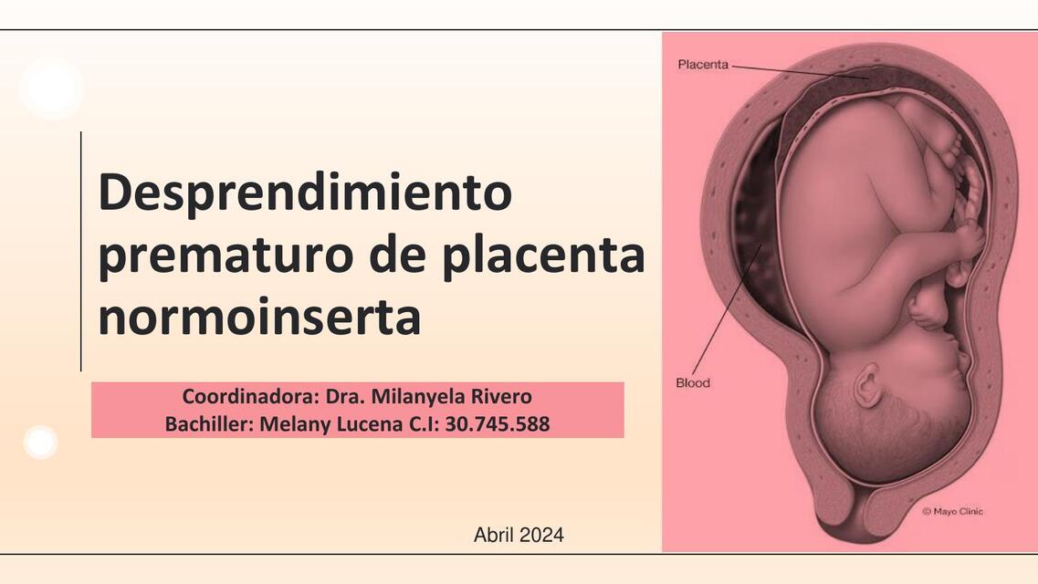 Desprendimiento prematuro de placenta