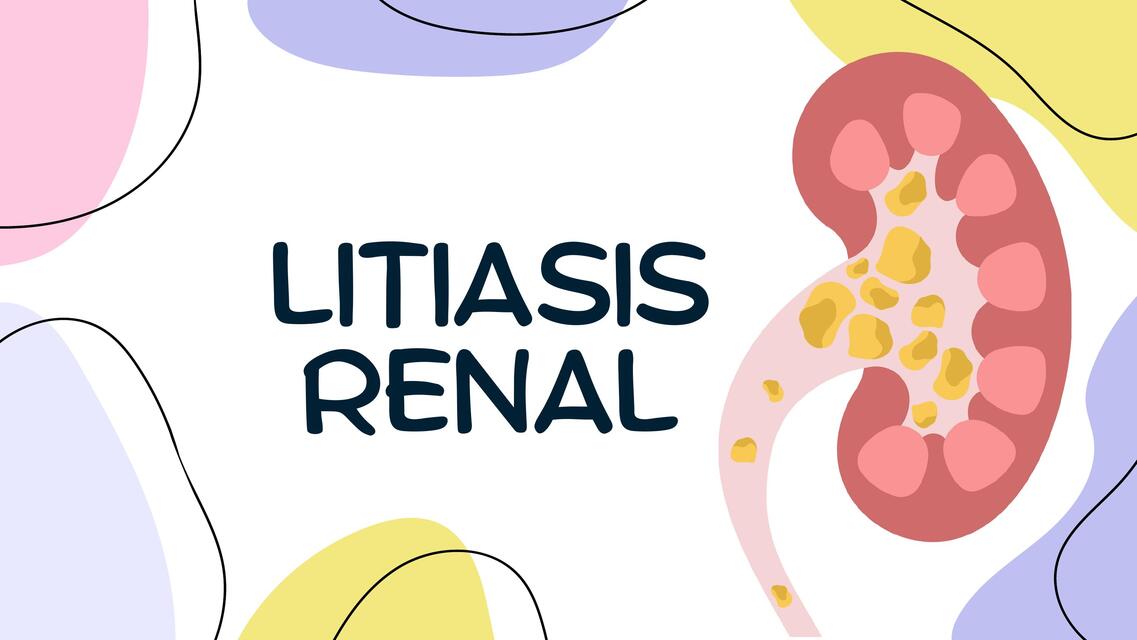 LITIASIS RENAL 2