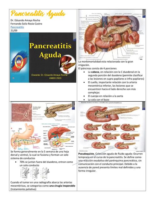 Pancreatitis aguda