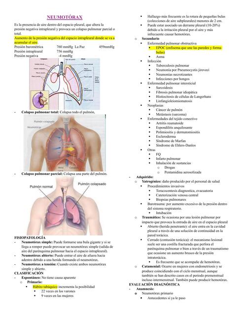 NEUMOTÓRAX DERRAME PLEURAL CANCER DE PULMÓN