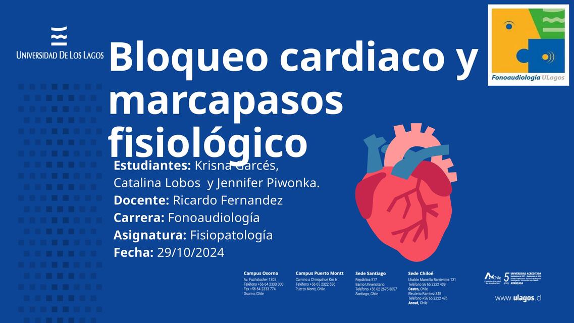 Bloqueo cardiaco y Marcapasos fisiologicos