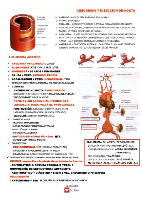 ANEURISMA Y DISECCIoN DE AORTA | Daiana | uDocz