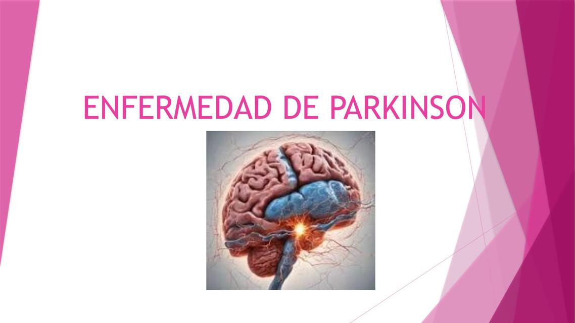 Enfermedad de Parkinson