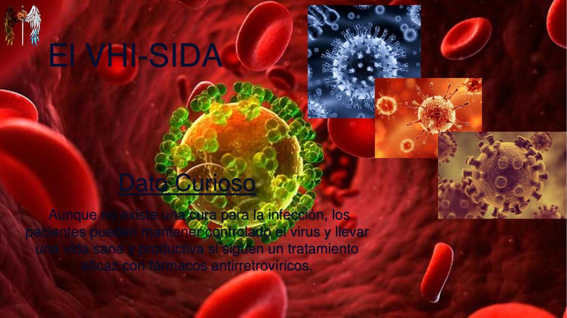 VIH- Sida