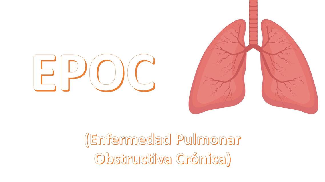 EPOC