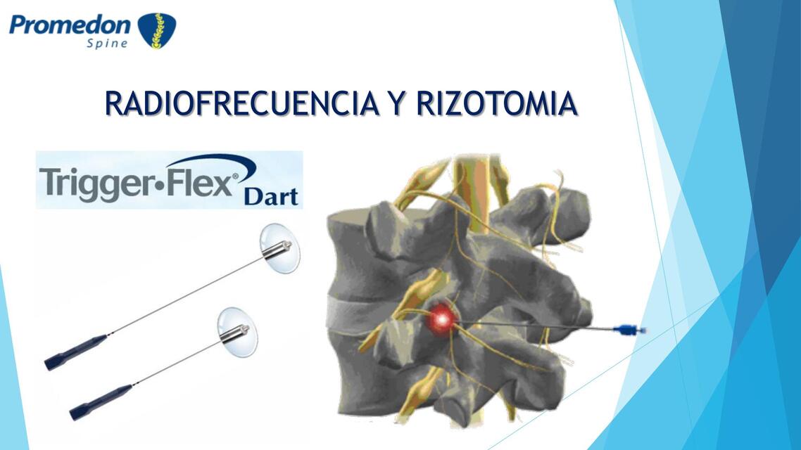 Radiofrecuencia y Rizotomia