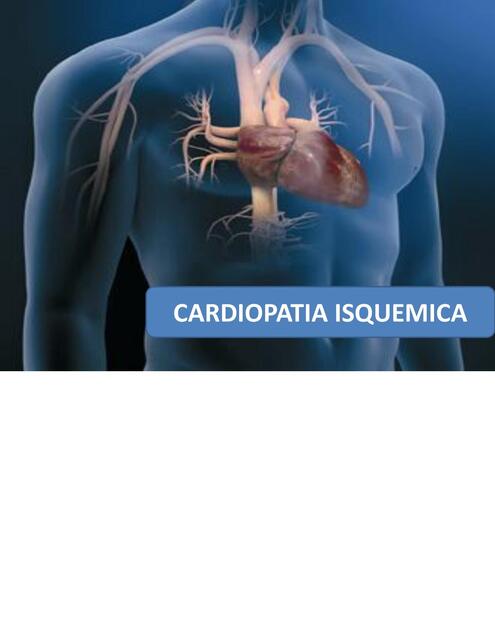 CARDIOPATIA ISQUEMICA