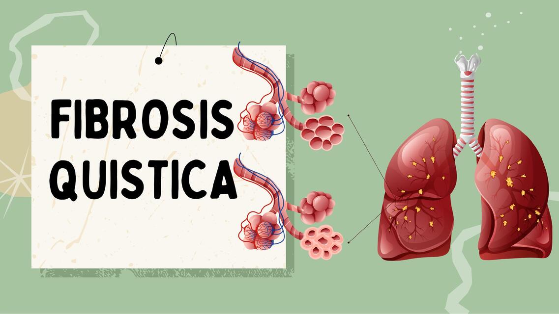 FIBROSIS QUISTICA GRUPO 4