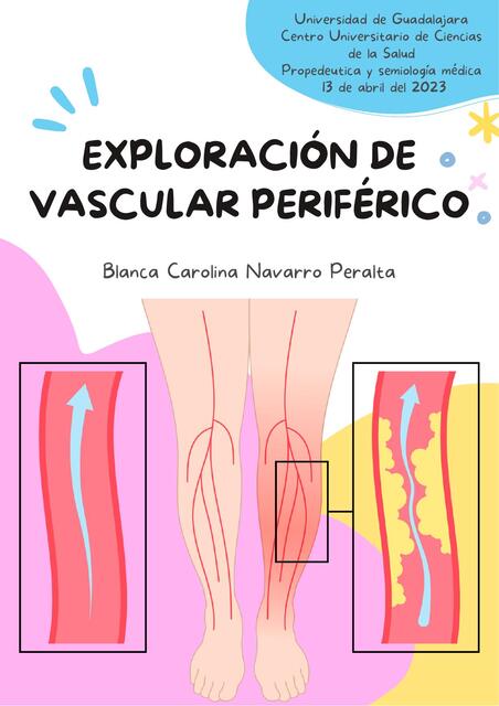 Exploración de vascular periférico