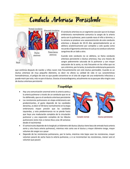 Conducto Arterioso Persistente y Coartación de Aorta