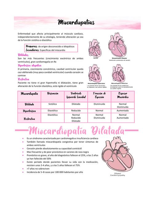 Miocardiopatías