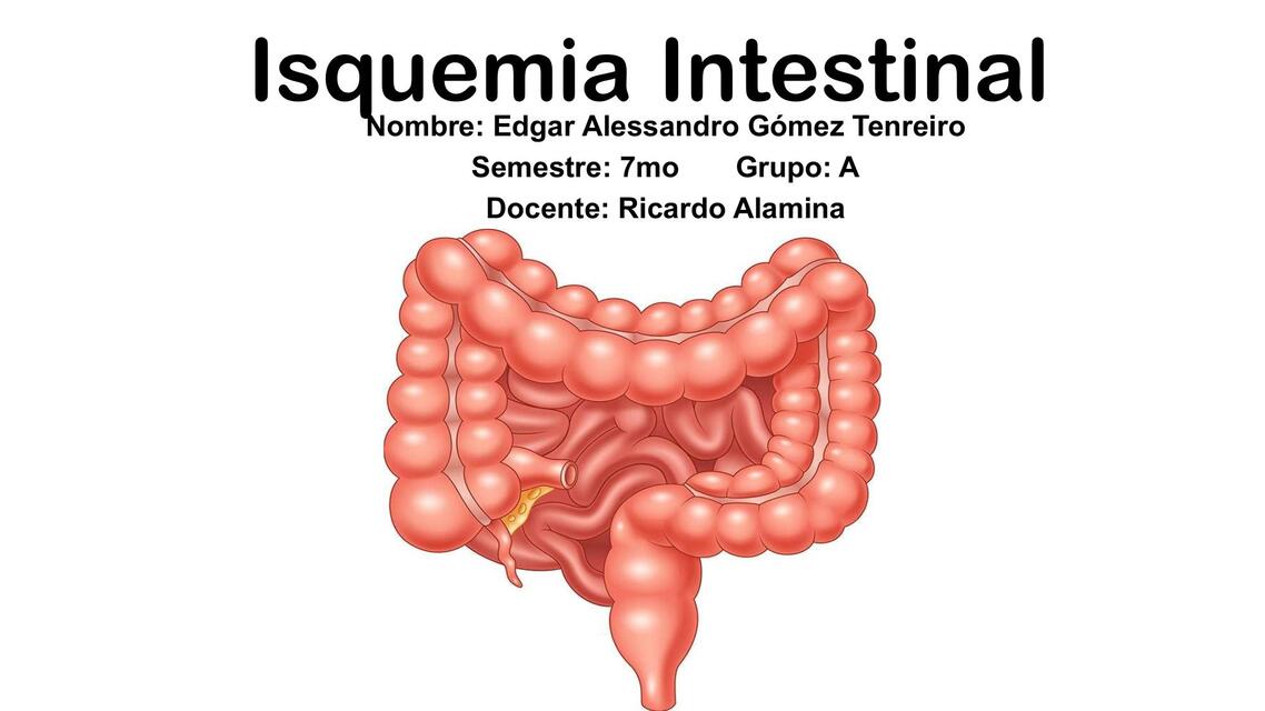 17 ISQUEMIA INTESTINAL