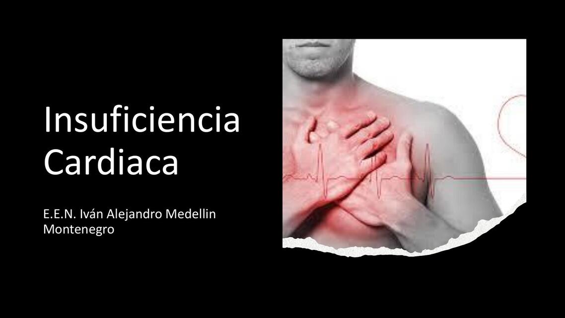 Insuficiencia Cardiaca